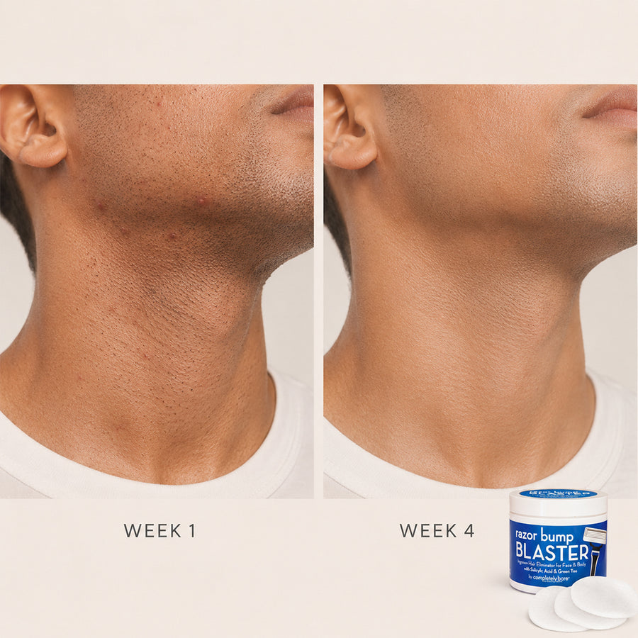 razor bump BLASTER Ingrown Hair & Razor Bump Eliminator for Men
