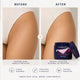 bikini bump BLASTER Ingrown Hair & Bikini Bump Eliminator