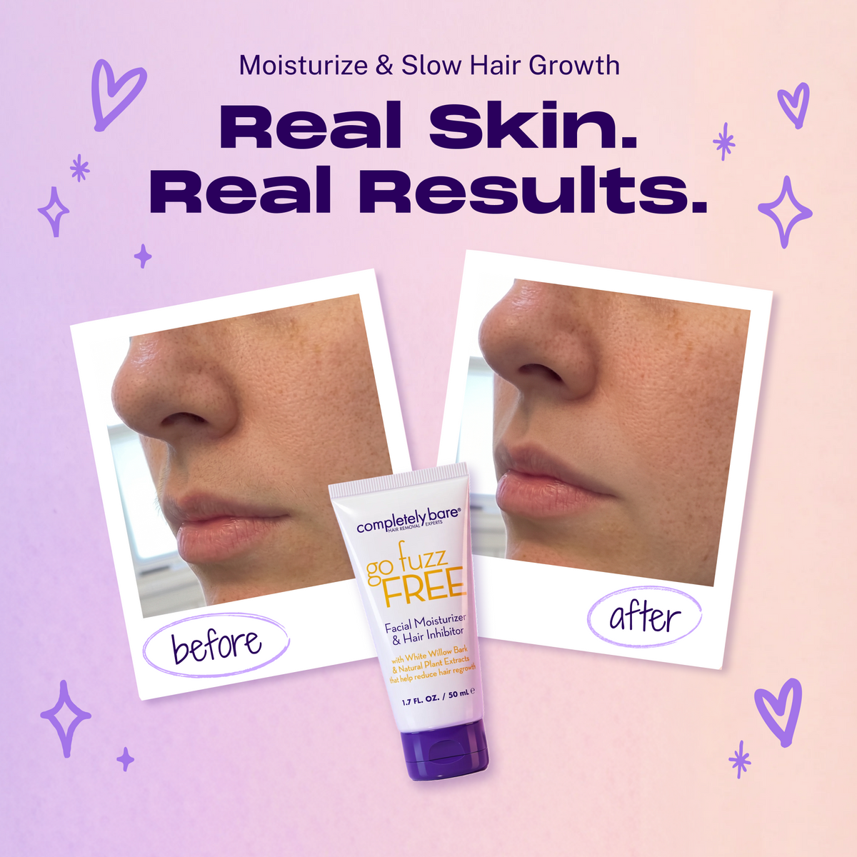 go fuzz FREE Facial Moisturizer & Hair Inhibitor